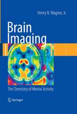 Brain Imaging: The Chemistry of Mental Activity