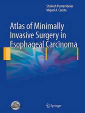 Atlas of Minimally Invasive Surgery in Esophageal Carcinoma