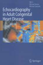 Echocardiography in Adult Congenital Heart Disease