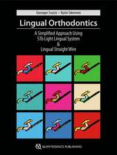 Lingual Orthodontics: A Simplified Approach Using STb Light Lingual System & Lingual Straight Wire