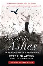 Out of the Ashes – The restoration of a burned boy