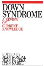 Down Syndrome – A Review of Current Knowledge