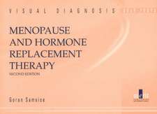 Menopause and Hormone Replacement Therapy