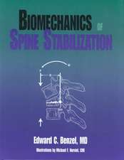 Biomechanics of Spine Stabilization