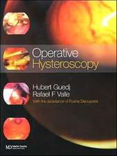 Operative Hysteroscopy