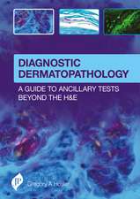 Diagnostic Dermatopathology: A Guide to Ancillary Tests Beyond the H&E