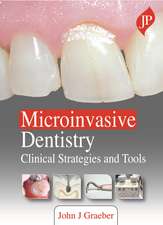 Microinvasive Dentistry