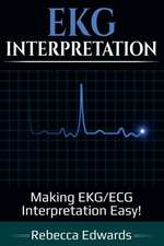 EKG Interpretation