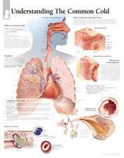 The Common Cold Chart: Wall Chart