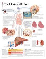 The Effects of Alcohol Chart: Laminated Wall Chart