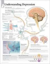 Understanding Depression Chart: Wall Chart