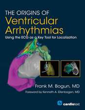 ORIGINS OF VENTRICULAR ARRHYTHMIAS PB