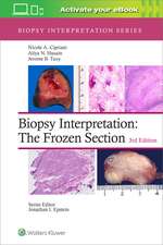 Biopsy Interpretation: The Frozen Section: Print + eBook with Multimedia