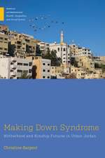 Making Down Syndrome: Motherhood and Kinship Futures in Urban Jordan