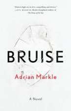 Bruise