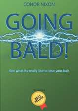 Going bald!