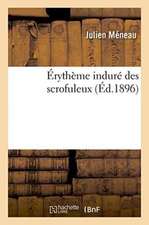 Érythème Induré Des Scrofuleux