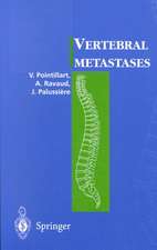 Vertebral metastases