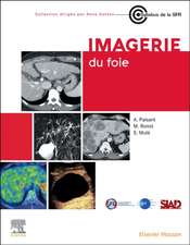 Imagerie du foie