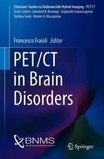 PET/CT in Brain Disorders