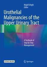 Urothelial Malignancies of the Upper Urinary Tract: A Textbook of Step by Step Management