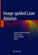 Image-guided Laser Ablation