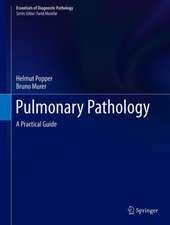 Pulmonary Pathology: A Practical Guide