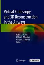 Virtual Endoscopy and 3D Reconstruction in the Airways