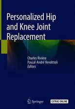 Personalized Hip and Knee Joint Replacement