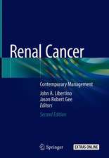 Renal Cancer: Contemporary Management