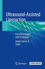 Ultrasound-Assisted Liposuction: Current Concepts and Techniques