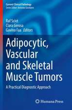 Adipocytic, Vascular and Skeletal Muscle Tumors: A Practical Diagnostic Approach