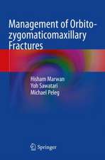 Management of Orbito-zygomaticomaxillary Fractures