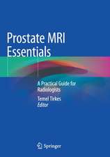 Prostate MRI Essentials: A Practical Guide for Radiologists