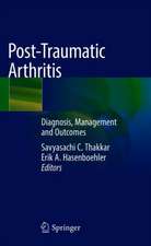 Post-Traumatic Arthritis: Diagnosis, Management and Outcomes