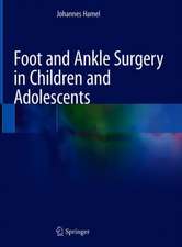 Foot and Ankle Surgery in Children and Adolescents