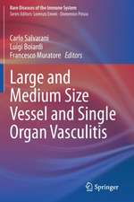 Large and Medium Size Vessel and Single Organ Vasculitis