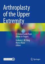 Arthroplasty of the Upper Extremity: A Clinical Guide from Elbow to Fingers