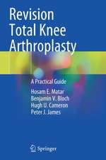 Revision Total Knee Arthroplasty: A Practical Guide