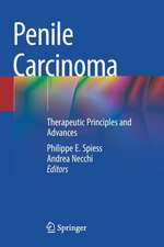 Penile Carcinoma: Therapeutic Principles and Advances