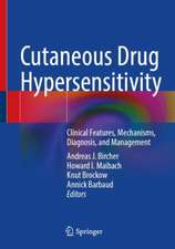 Cutaneous Drug Hypersensitivity: Clinical Features, Mechanisms, Diagnosis, and Management