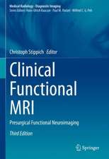 Clinical Functional MRI: Presurgical Functional Neuroimaging