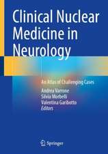 Clinical Nuclear Medicine in Neurology: An Atlas of Challenging Cases