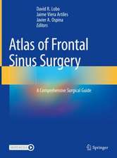 Atlas of Frontal Sinus Surgery: A Comprehensive Surgical Guide