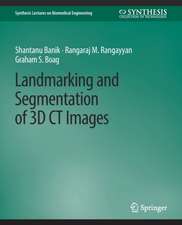 Landmarking and Segmentation of 3D CT Images