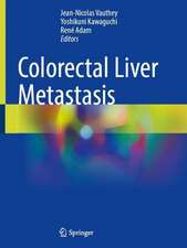 Colorectal Liver Metastasis