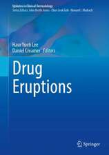 Drug Eruptions