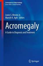 Acromegaly: A Guide to Diagnosis and Treatment