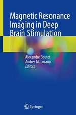 Magnetic Resonance Imaging in Deep Brain Stimulation