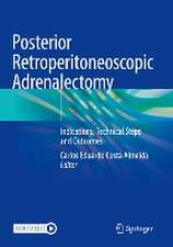 Posterior Retroperitoneoscopic Adrenalectomy: Indications, Technical Steps and Outcomes